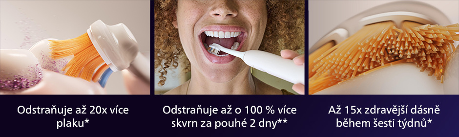 Philips HX9094/87 Sonicare Premium All-in-One