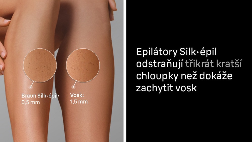 Chloupky na noze