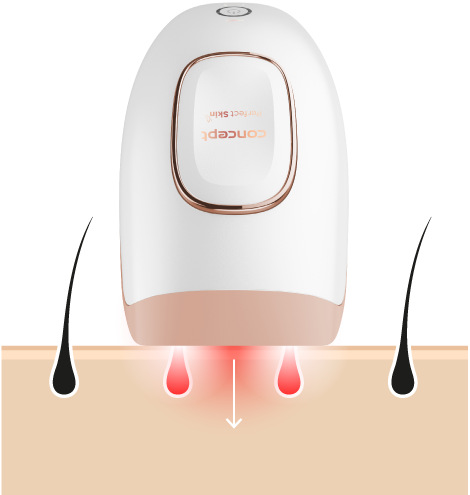 Epilátor Concept Perfect Skin IL3000