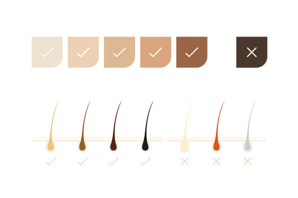 Epilátor Concept Perfect Skin PRO IL5020, IPL