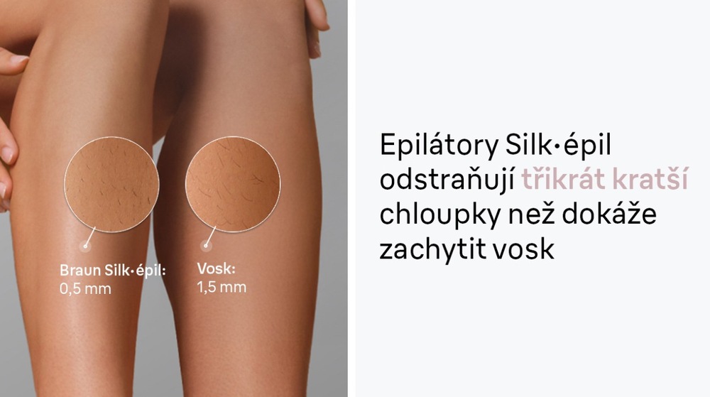 Chloupky na noze