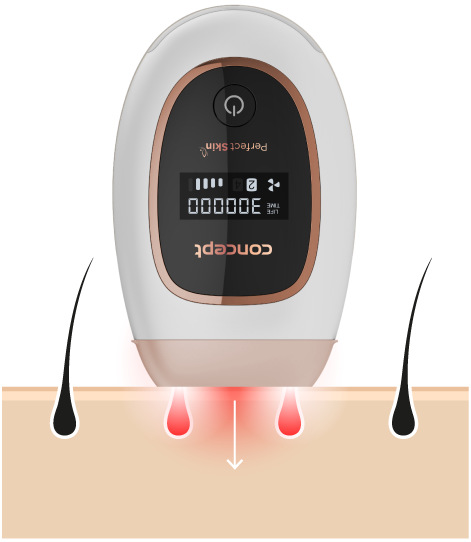 Epilátor Concept Perfect Skin IL3020