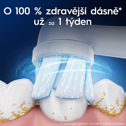 Náhradní hlavice Oral-B iO Gentle Care White (6 ks) bílá Pohled na kulatou kartáčovou hlavu, která efektivně čistí zuby, první výsledky jsou viditelné již během prvního týdne.