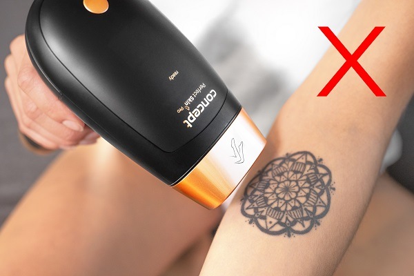 Epilátor Concept Perfect Skin PRO IL5020, IPL