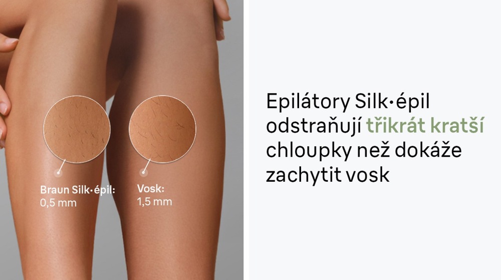 Chloupky zachycené na noze