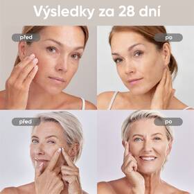LED maska JOVS JM2P hnědá

 obrázek produktu 8 z 10