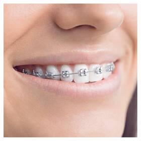 Náhradní kartáček Oral-B OD 17-3 ORTHO 

 obrázek produktu 1 z 6