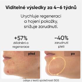 LED maska JOVS JM2C hnědá

 obrázek produktu 6 z 9