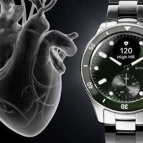 Chytré hodinky Withings Scanwatch Nova 42 mm stříbrné/zelené

 obrázek produktu 5 z 7