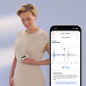 Teploměr Withings BeamO 4-in-1 MultiScan bílý

 obrázek produktu 5 z 9