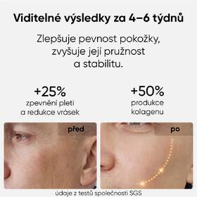 LED maska JOVS JM2C hnědá

 obrázek produktu 7 z 9