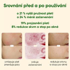 Přístroj na péči o pleť JOVS JP1P zelený

 obrázek produktu 6 z 8