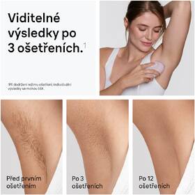 Epilátor Braun IPL1100 růžový

 obrázek produktu 2 z 11
