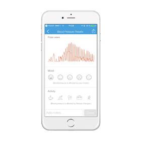 Tlakoměr na zápěstí iHealth VIEW BP7 bílý

 obrázek produktu 13 z 15