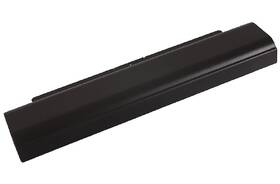 Baterie PATONA pro LENOVO L440/T440p 5200mAh Li-Ion 10,8V 45N1145 Premium 

 obrázek produktu 2 z 2
