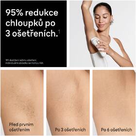 Epilátor Braun IPL5210 bílý/zlatý

 obrázek produktu 5 z 10