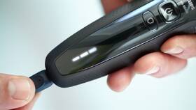 Holicí strojek Philips S6640/44 černý

 obrázek produktu 6 z 8