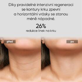 LED maska JOVS JNL1 hnědá

 obrázek produktu 2 z 8