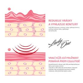 Masážní přístroj Vigan Lady ONE černý

 obrázek produktu 6 z 7
