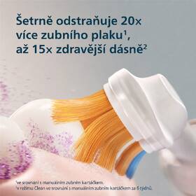 Zubní kartáček Philips HX8311/15 růžový

 obrázek produktu 11 z 14